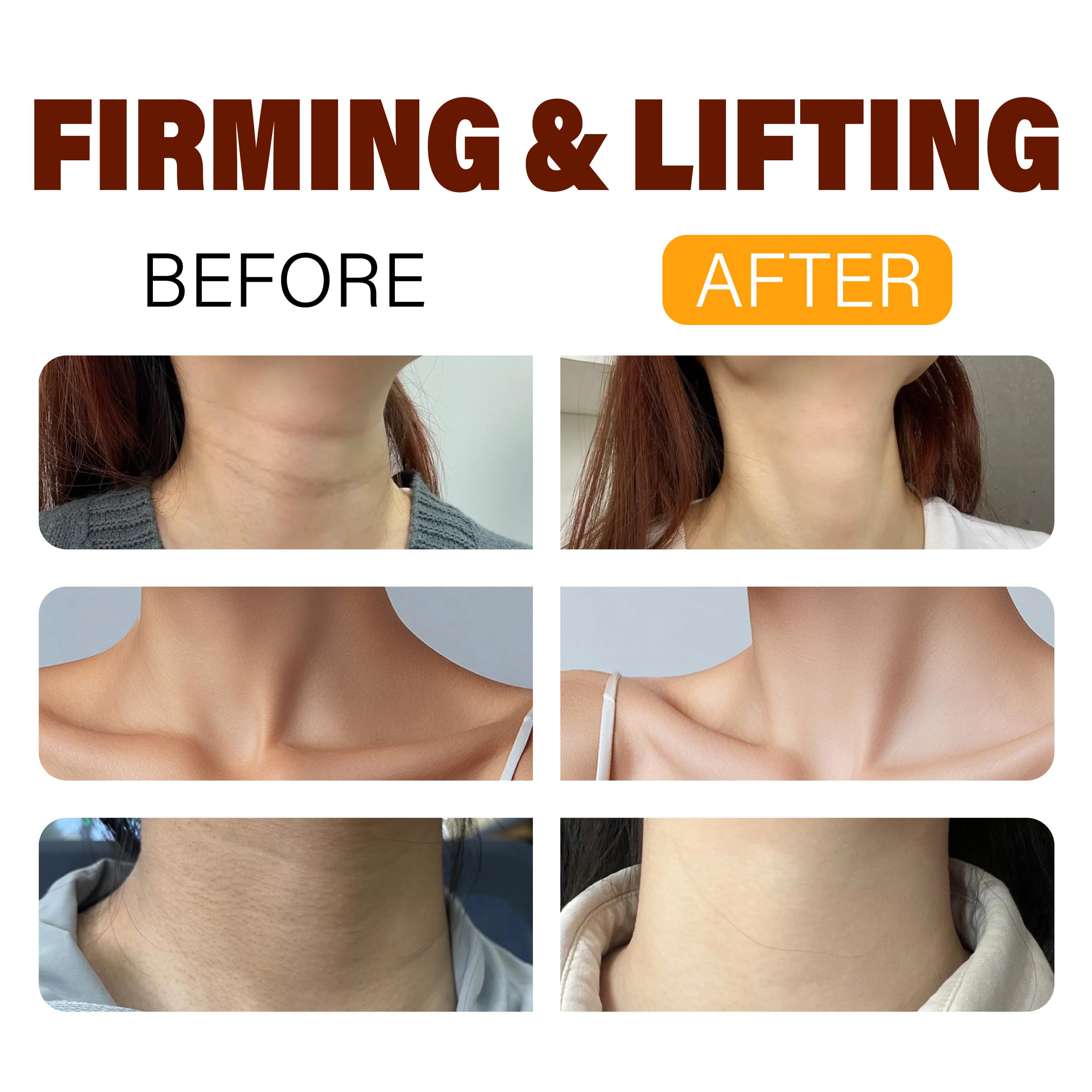 BYMOLIA Neck Firming Cream with Roller – Anti-Aging Neck & Chest, Collagen + Hyaluronic Acid