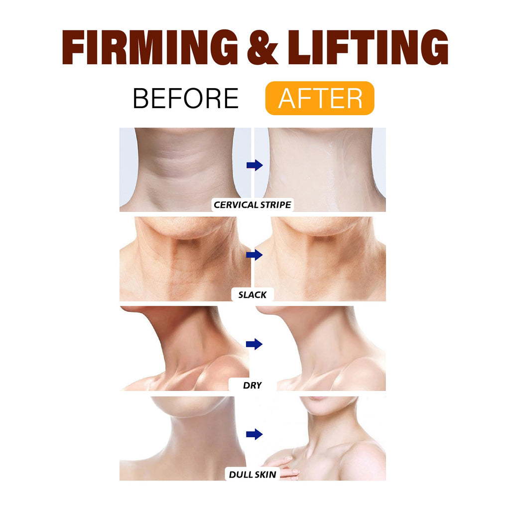 BYMOLIA Neck Firming Cream with Roller – Anti-Aging Neck & Chest, Collagen + Hyaluronic Acid
