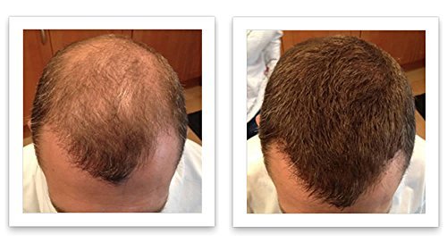 Caboki Hair Building Fiber Auburn – 30g, 90-Day Supply | Instant Coverage
