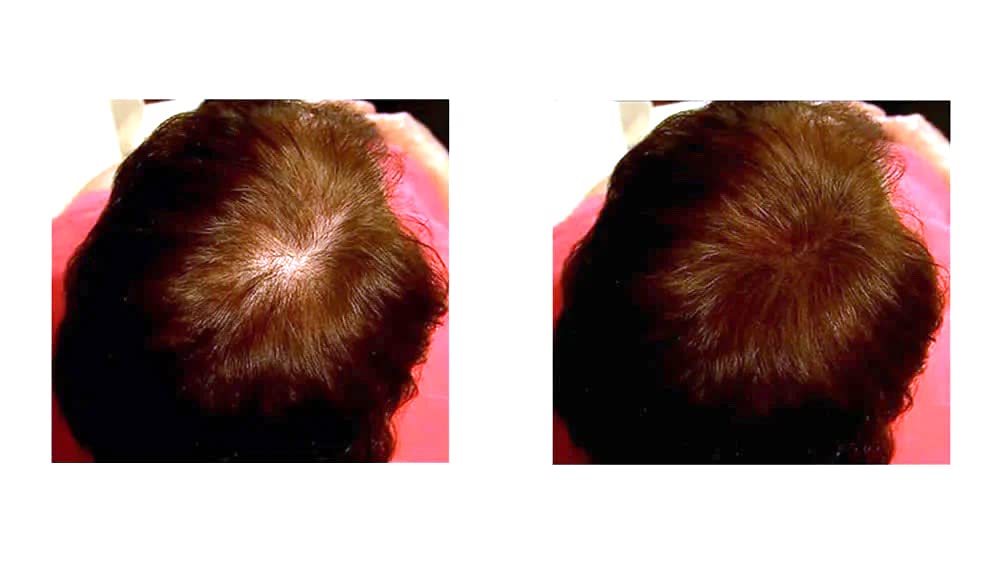 Caboki Hair Building Fiber Auburn – 30g, 90-Day Supply | Instant Coverage