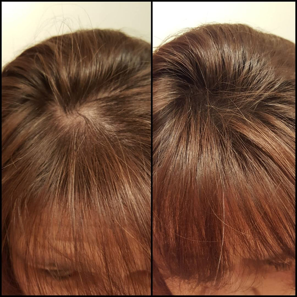 Caboki Hair Building Fiber Auburn – 30g, 90-Day Supply | Instant Coverage