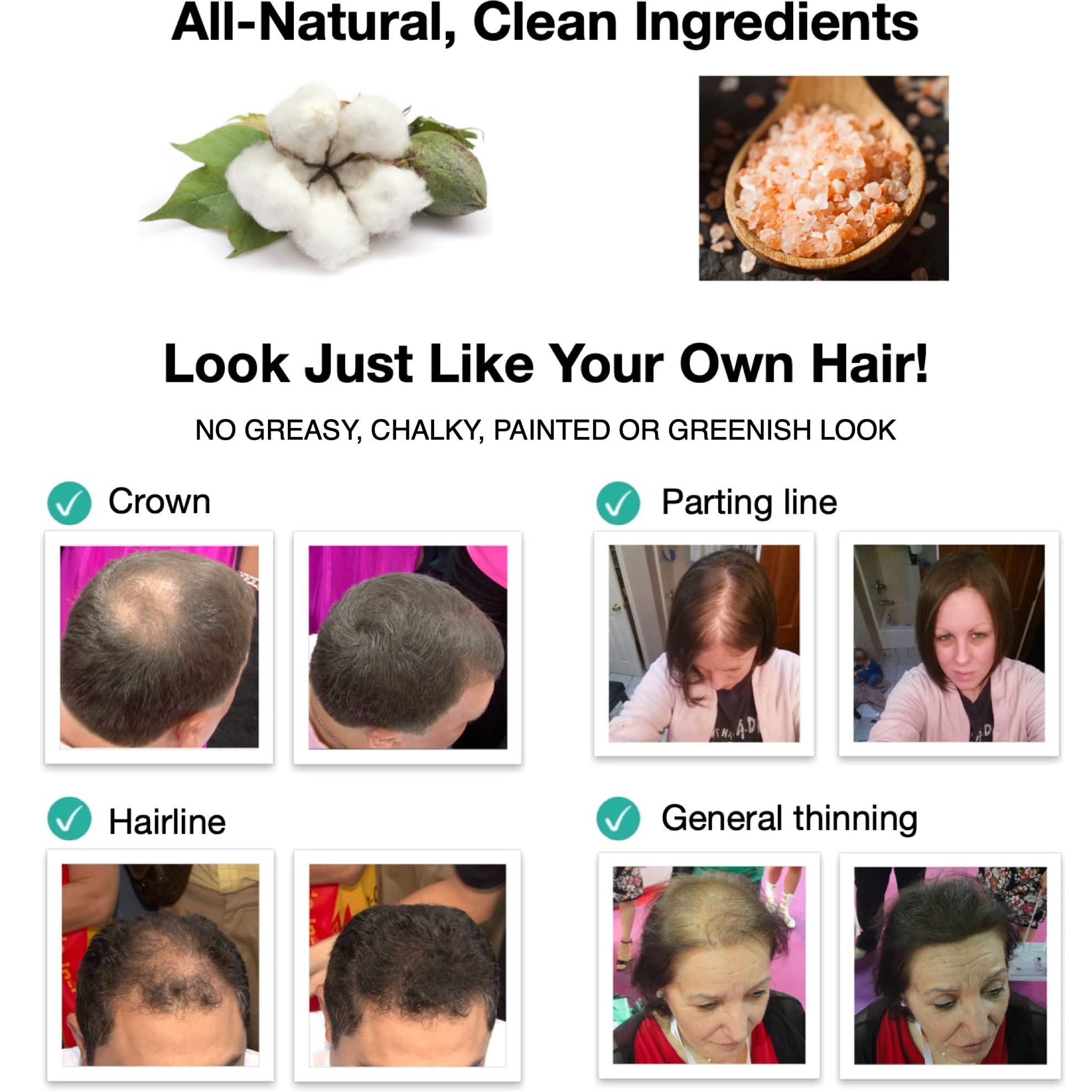 Caboki Hair Loss Concealer – All-Natural Plant Fibers for Instant Fuller Look (Natural Blonde, 30g)