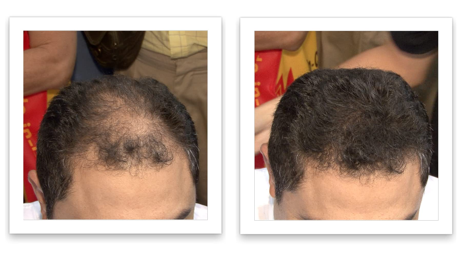 Caboki Hair Loss Concealer – 90-Day Supply, Dark Brown | Instantly Fuller-Looking Coverage