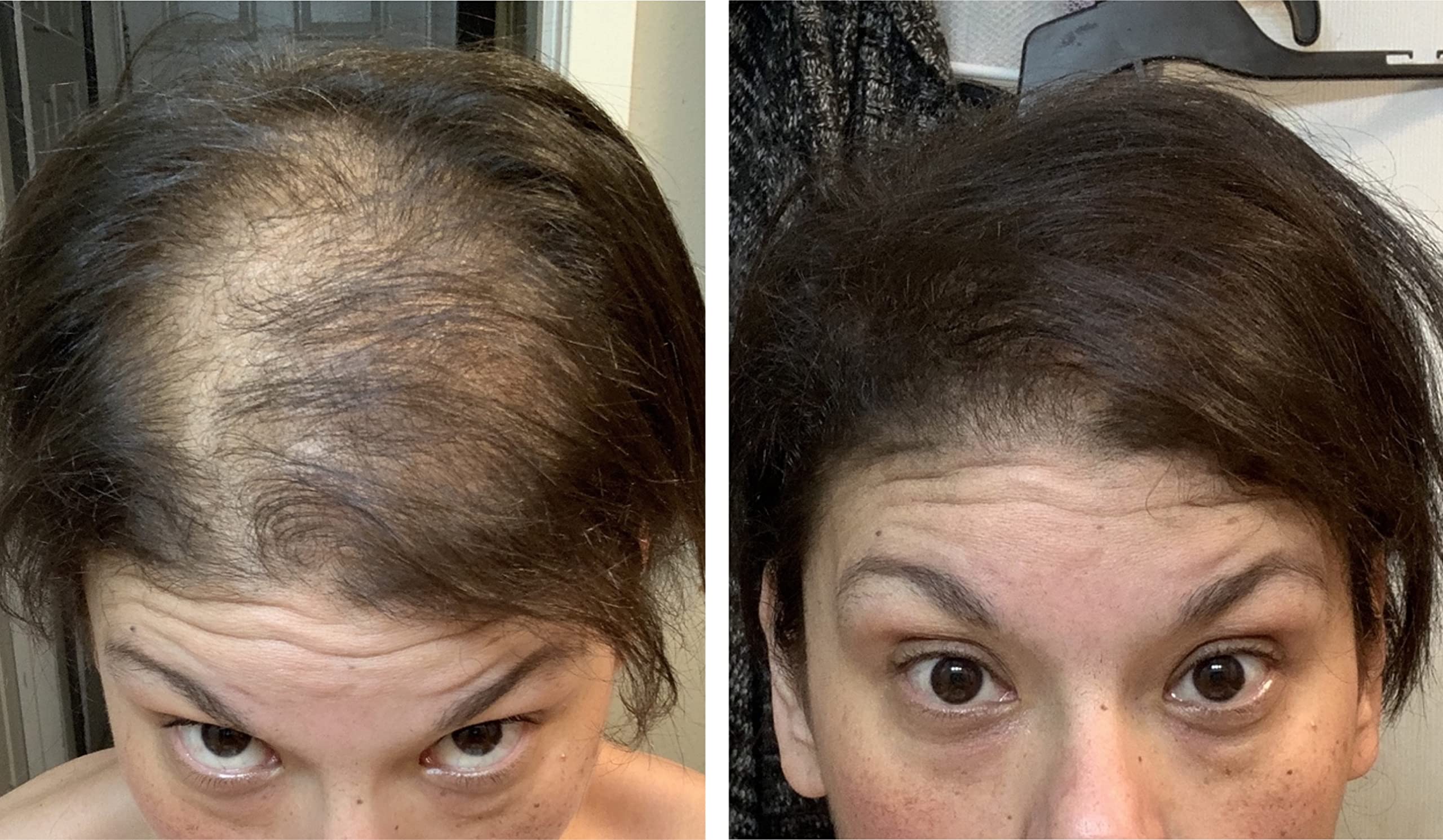 Caboki Hair Loss Concealer – 90-Day Supply, Dark Brown | Instantly Fuller-Looking Coverage