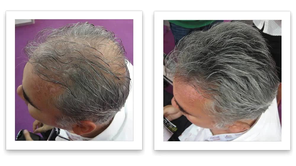 Caboki Hair Loss Concealer – 90-Day Dark Gray Coverage, Instant Fuller Look
