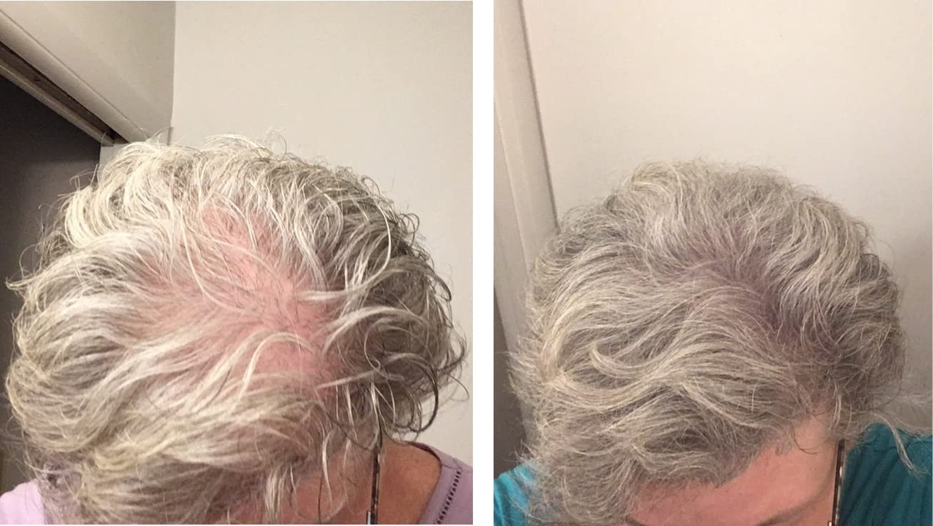 Caboki Hair Loss Concealer — All-Natural Fibers for Instant Fuller Hair (30g, 90-Day Supply, Gray)