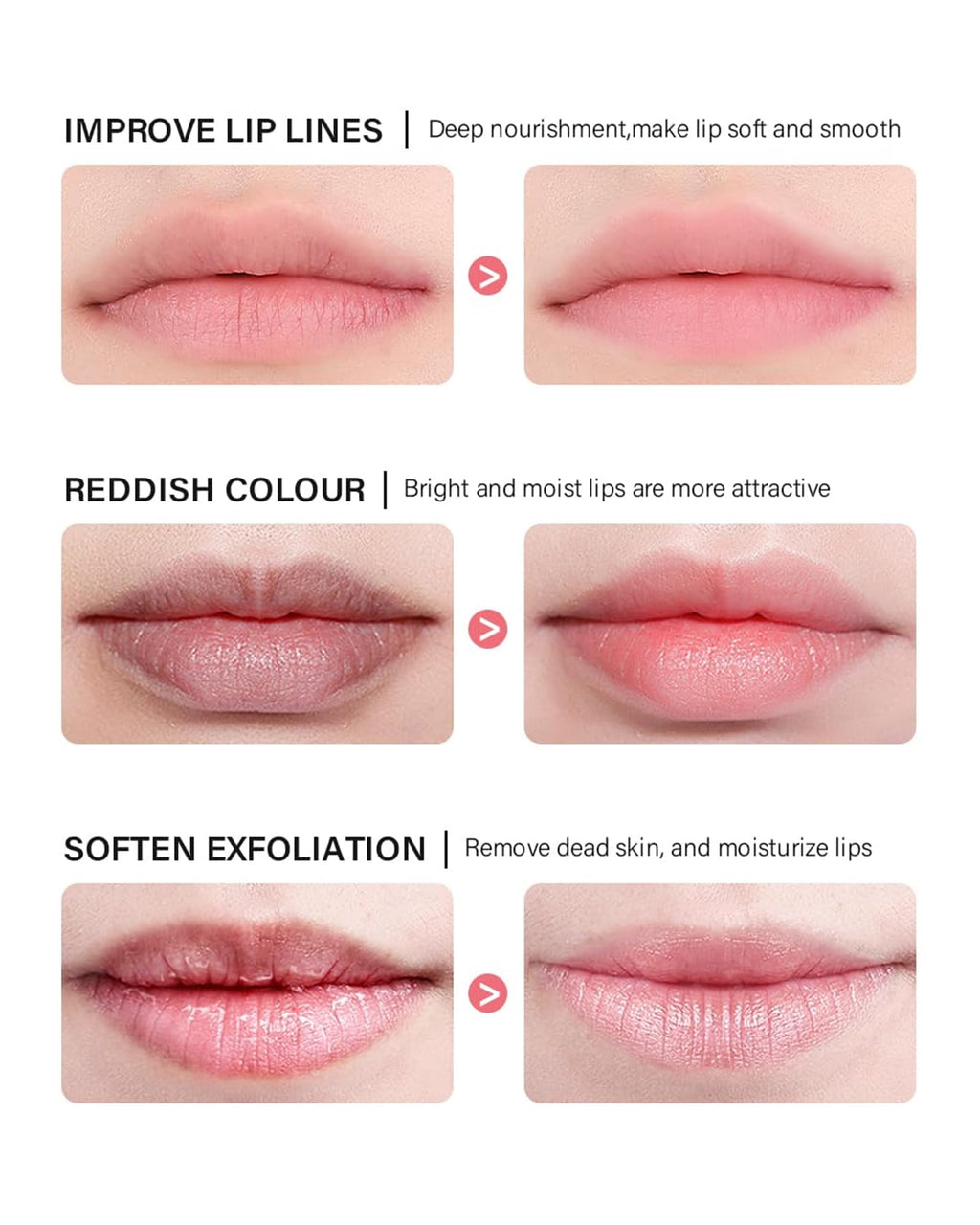 Caedelfly Lip Sleeping Mask Set – 6 Pcs Hydrating Overnight Lip Treatments