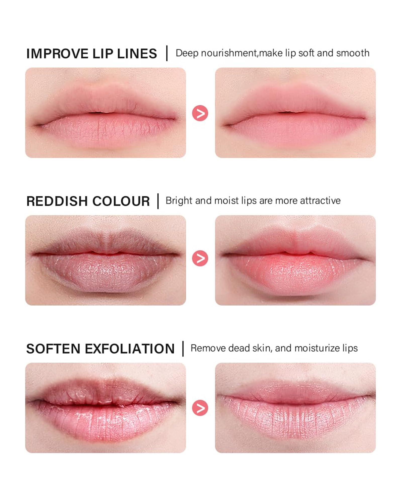 Caedelfly Lip Sleeping Mask Set – 6 Pcs Hydrating Overnight Lip Treatments
