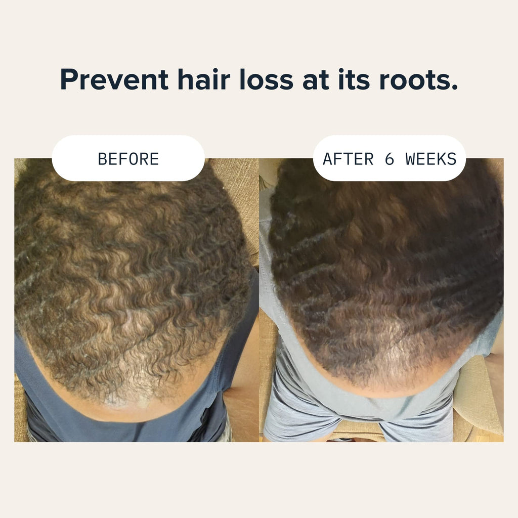 Cardon Hair Growth Conditioner for Men – Niacinamide & Vitamin B5 for a Healthy Scalp