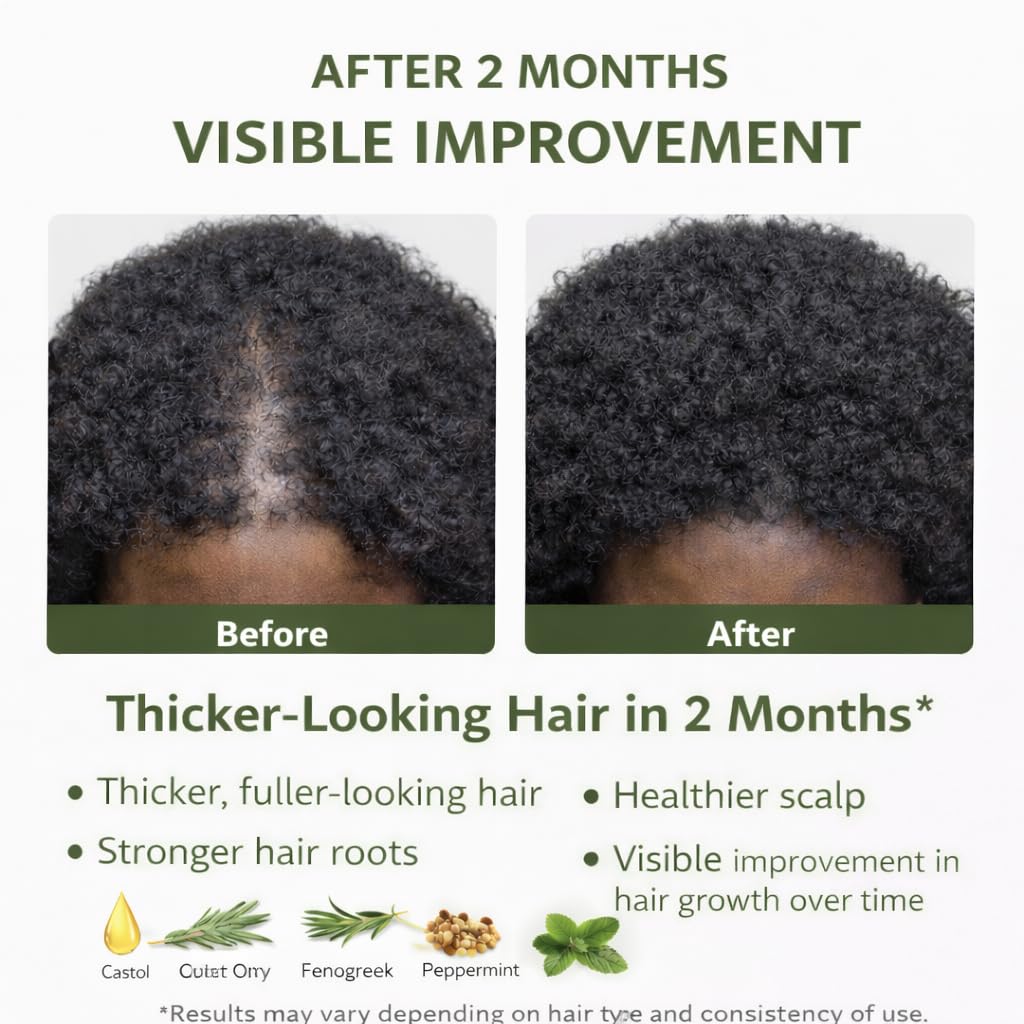 Castor Oil Hair Growth with Rosemary, Fenugreek & Peppermint – 100% Pure Organic, 4 oz