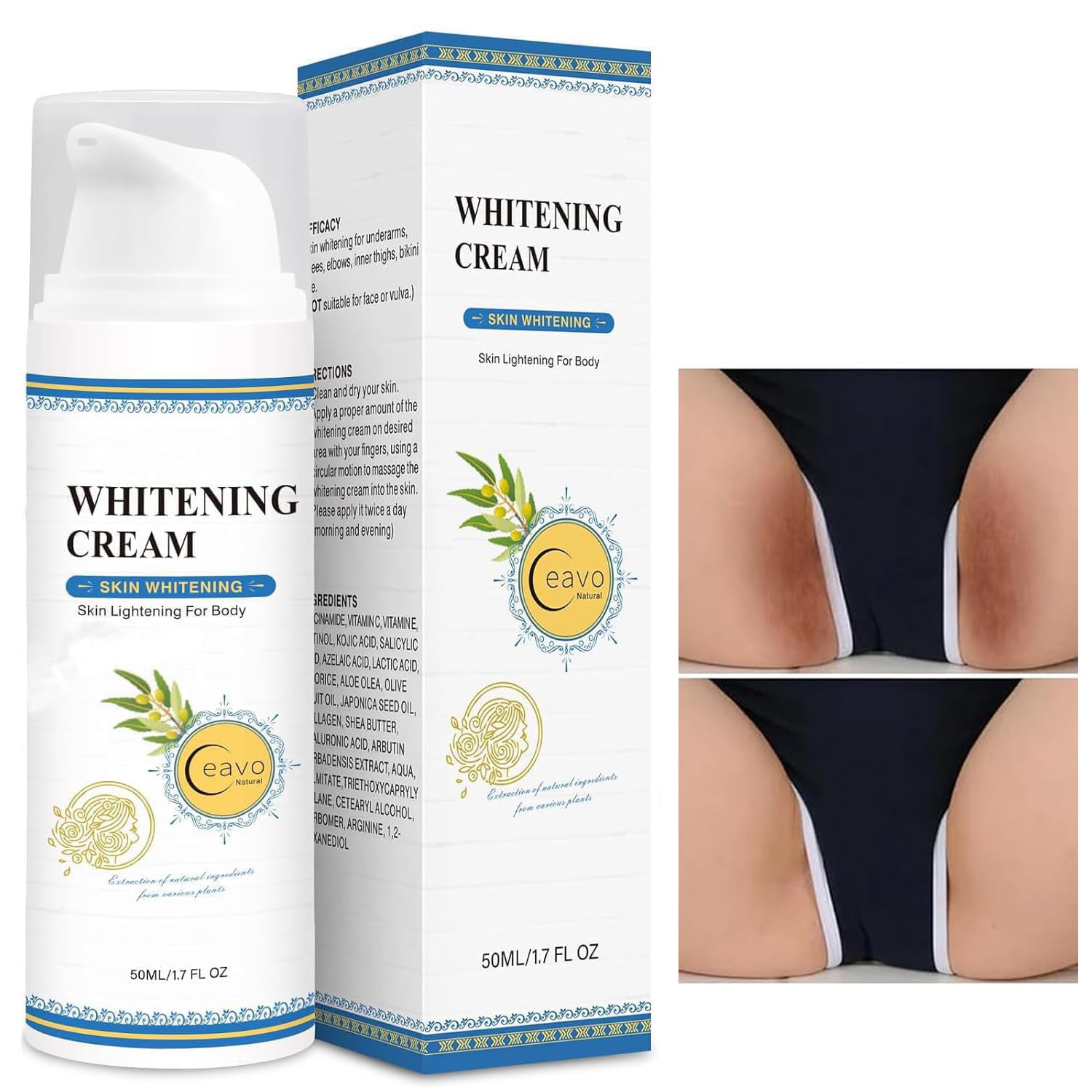 Ceavo Skin Whitening Cream for Intimate Areas – Body, Underarms & Bikini Line (1.7 FL OZ)