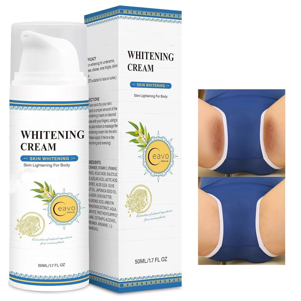 Ceavo Skin Whitening Cream for Intimate Areas – Body, Underarms & Bikini Line (1.7 FL OZ)