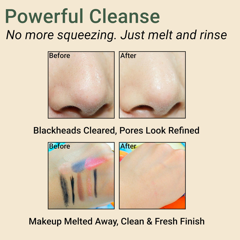 CELDYQUE Korean Double Cleanse Duo – Oil Cleanser + Gentle Foam Wash for Sensitive Skin