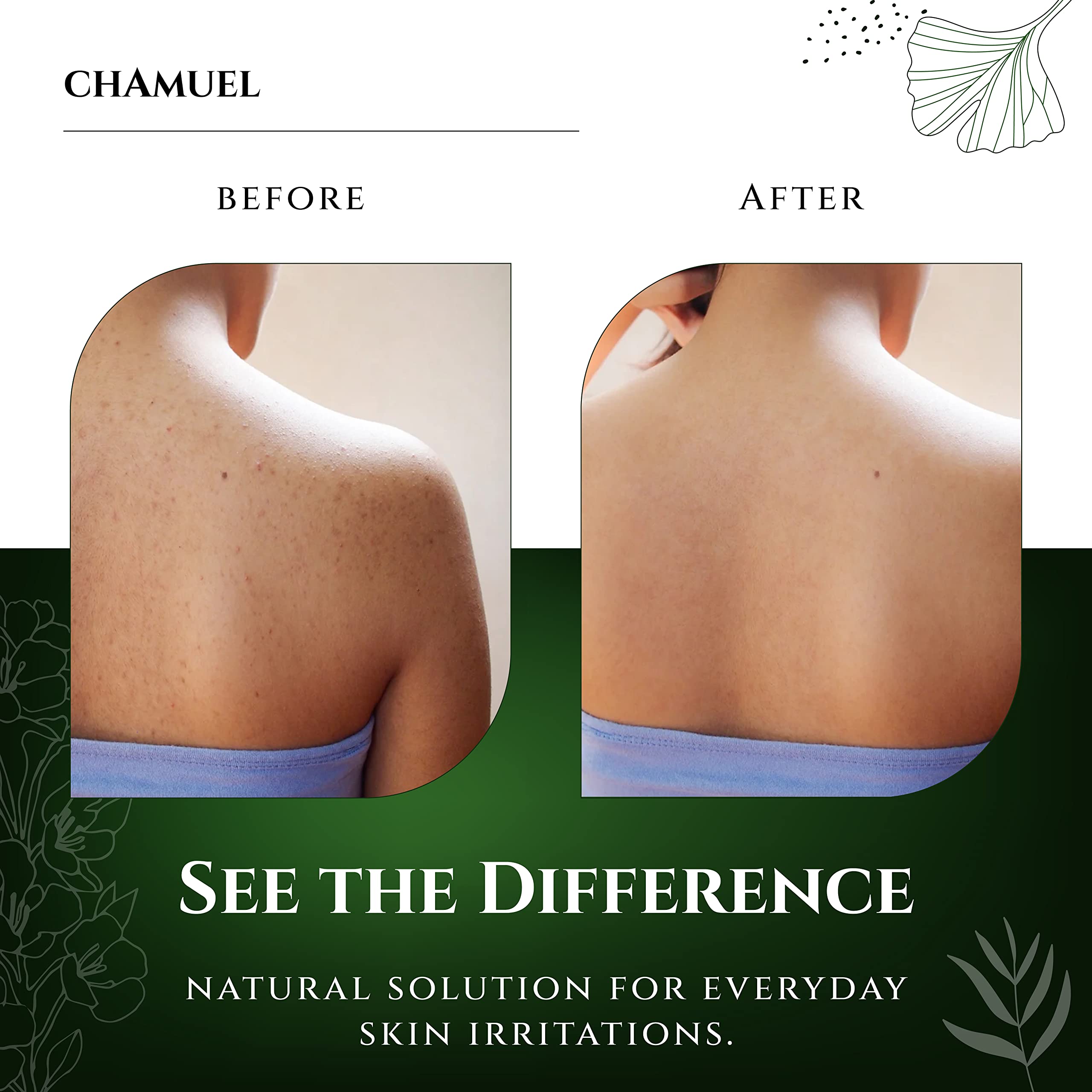 Chamuel Tea Tree Body Wash – 100% Natural, Gentle Cleanse for All Skin Types (11.8 oz)