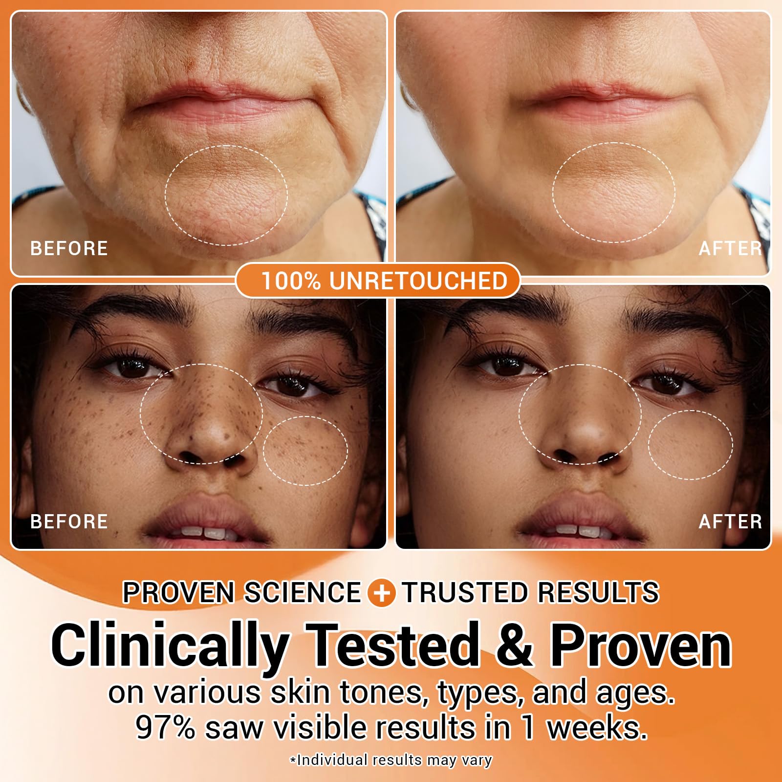 CHANGARLOAD 30% Vitamin C Serum with Hyaluronic Acid & Rose Stem Cells – Brighten, Smooth, and Support Radiant Skin