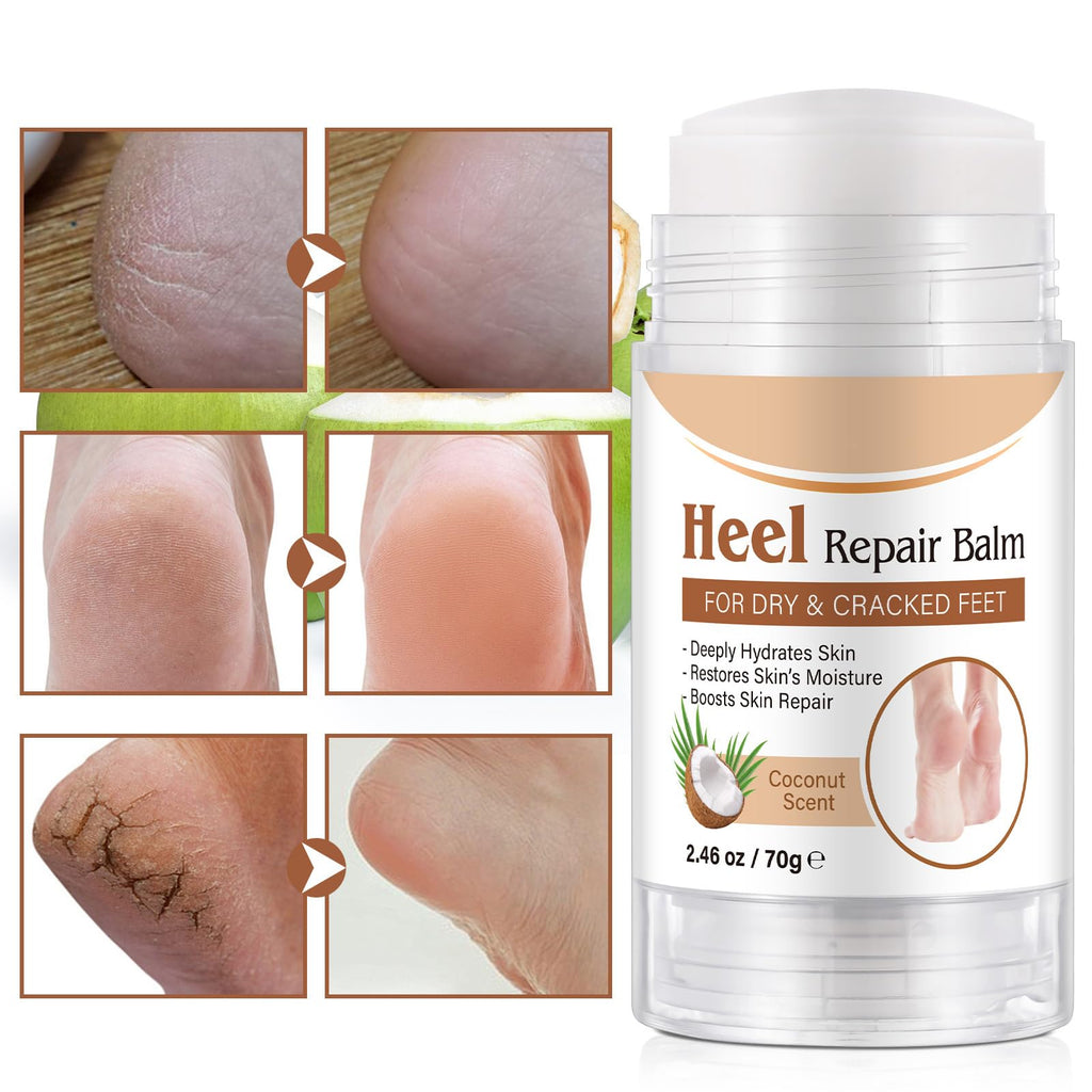 chenyayun 2 Pack Cracked Heel Treatment Balm Stick – Intensive Foot Repair with Aloe, Coconut Oil, Hyaluronic Acid (70 g)