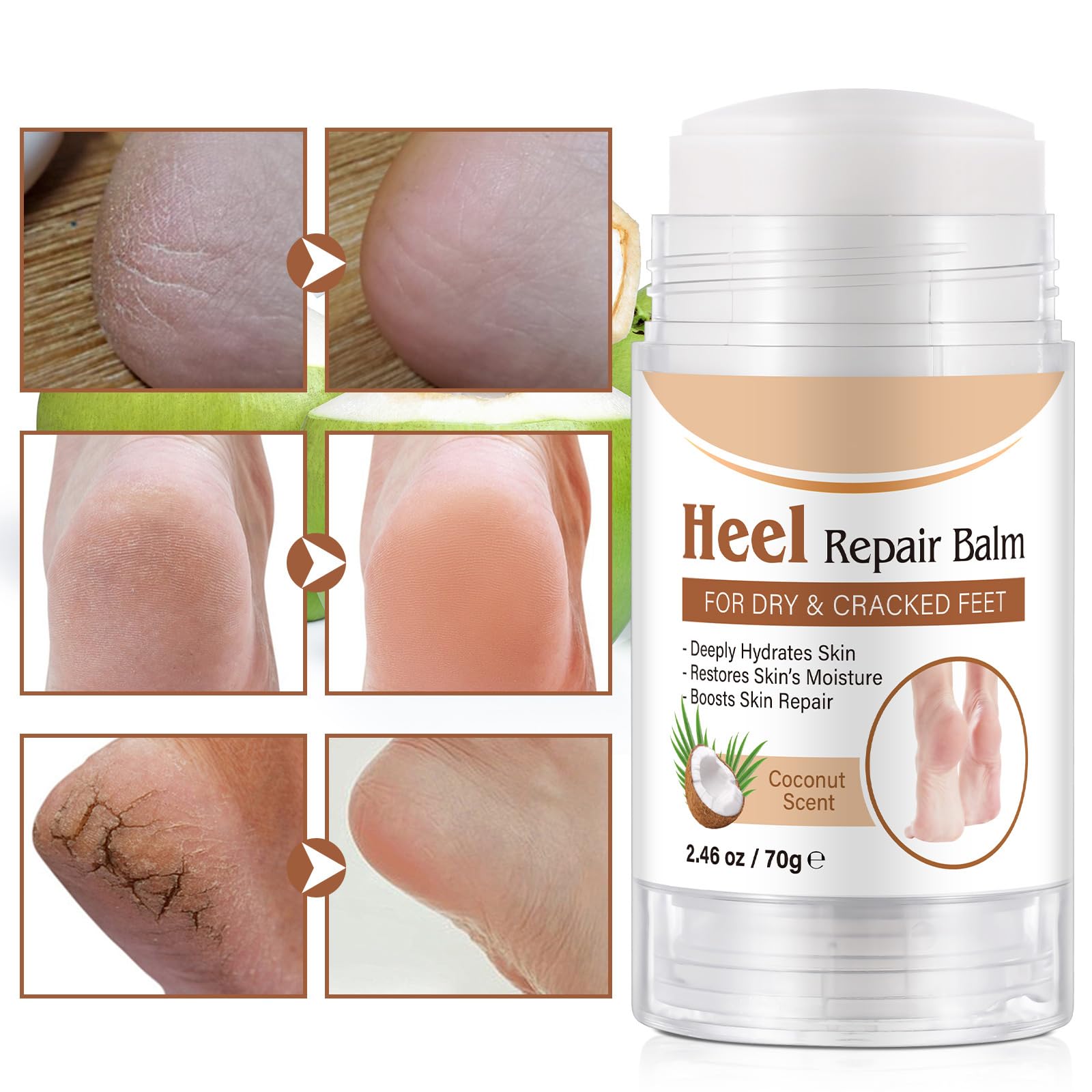 chenyayun 2 Pack Cracked Heel Treatment Balm Stick – Intensive Foot Repair with Aloe, Coconut Oil, Hyaluronic Acid (70 g)
