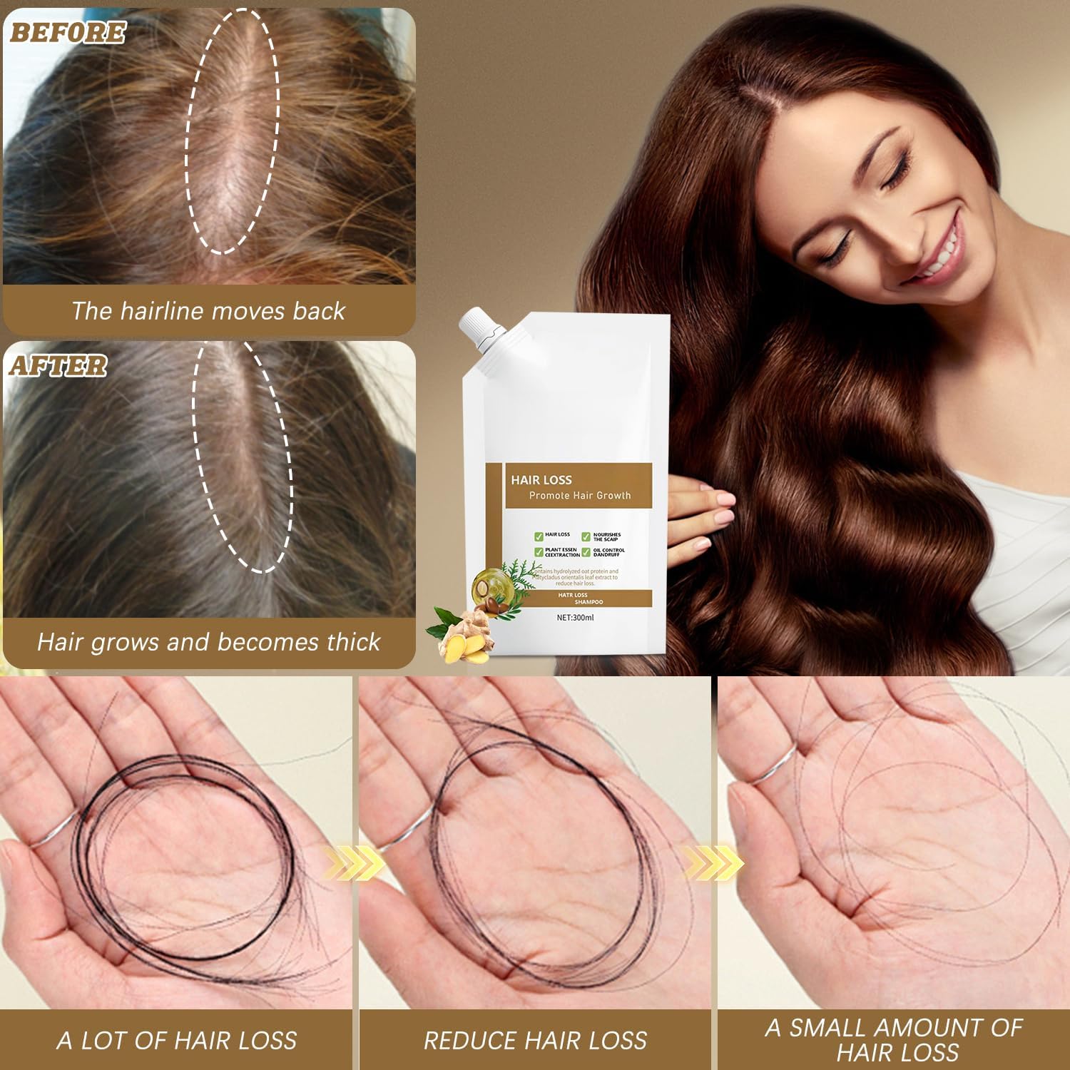 Ciirvoe 300ml Anti-Hair Fall Shampoo – Promote Growth with Plant Extracts | All Hair Types