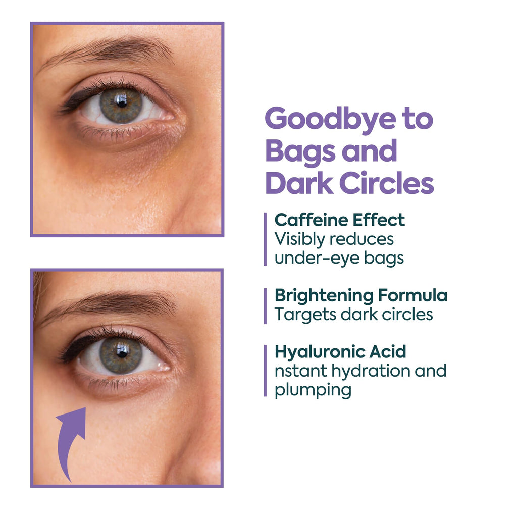 Clasy Care Under Eye Cream – Dark Circles & Puffiness, 5% Caffeine + 2% Hyaluronic Acid