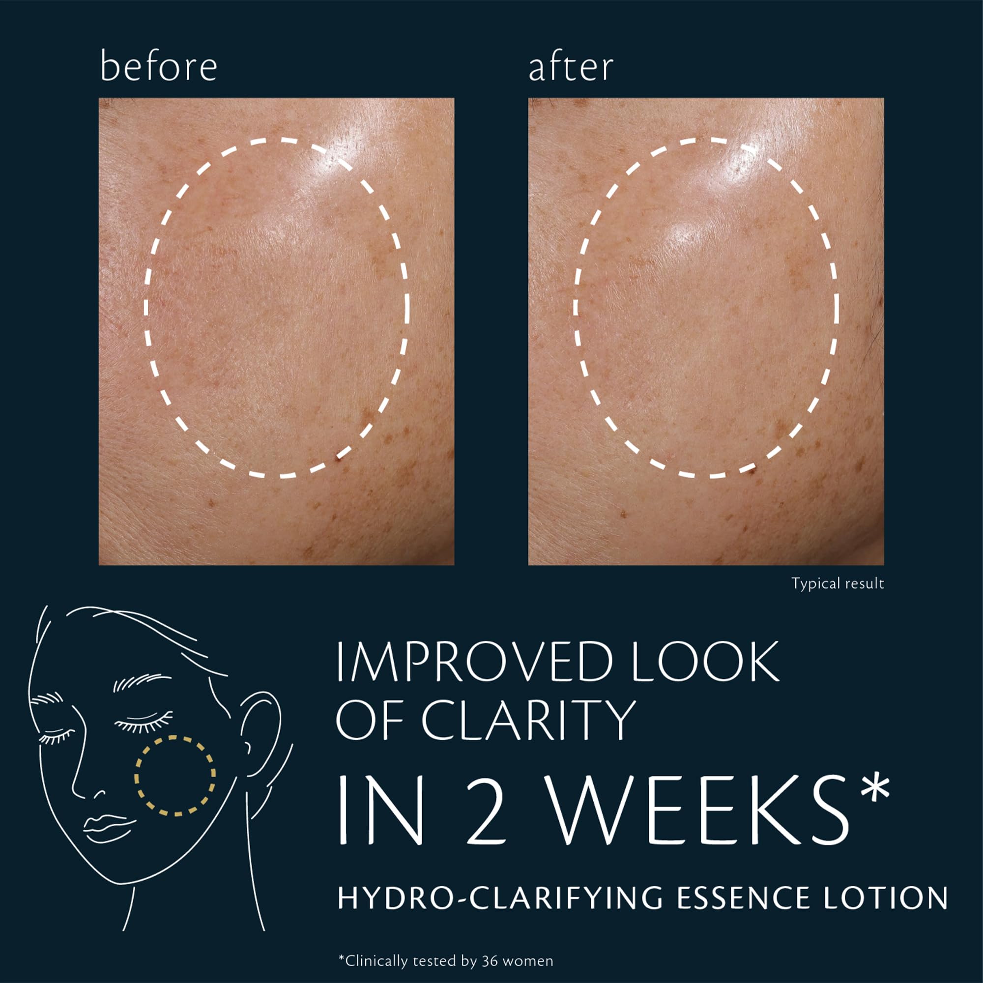 Clé de Peau Beauté Hydro-Clarifying Essence Lotion – Hydration & Refinement for Normal to Oily Skin