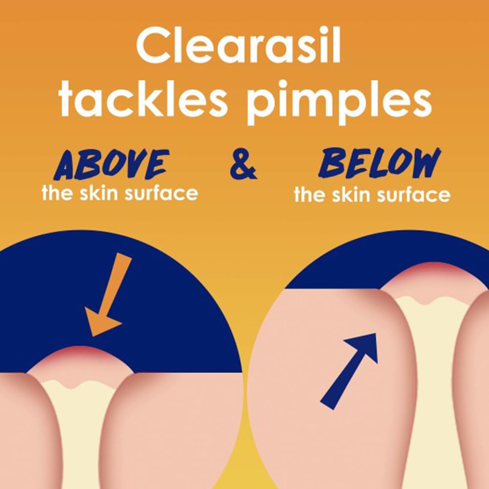 Clearasil Stubborn Acne Control 5in1 Exfoliating Wash – Pack of 5 (6.78 fl oz each)