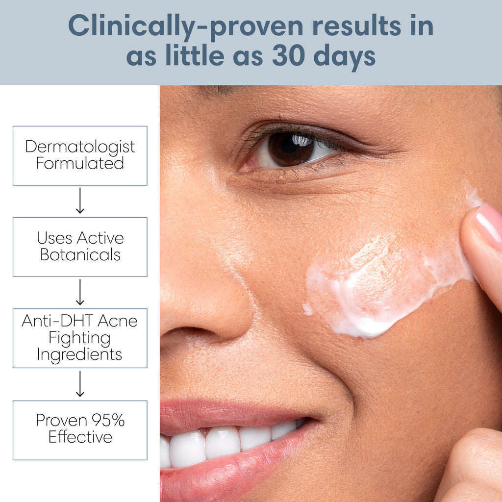 Clearogen Sensitive Skin Sulfur Acne Lotion - Acne Treatment 1.8 oz
