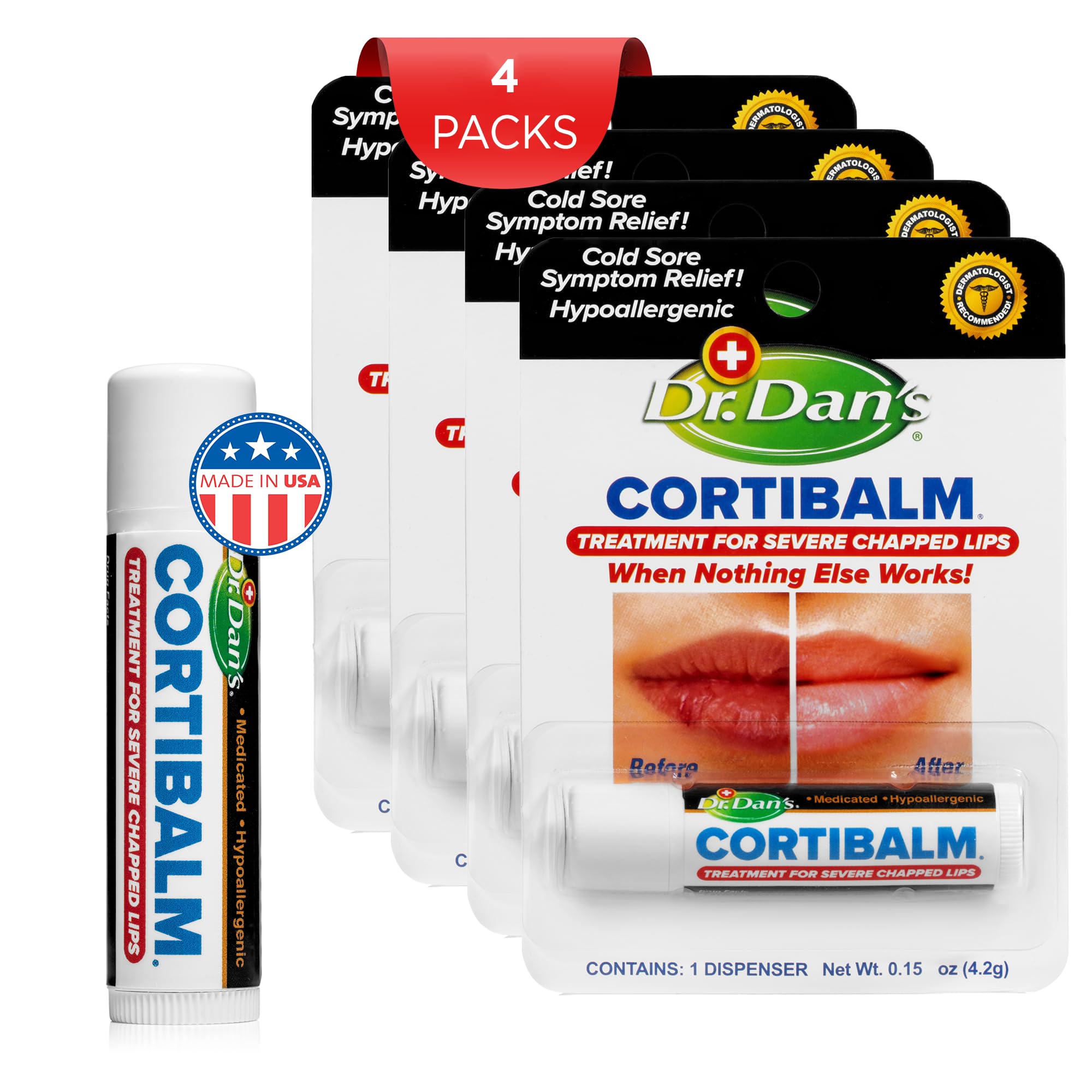 Dr. Dan's Cortibalm 4 Pack – Lip Balm for Severe Chapped Lips (1% Hydrocortisone), Gentle & Hypoallergenic