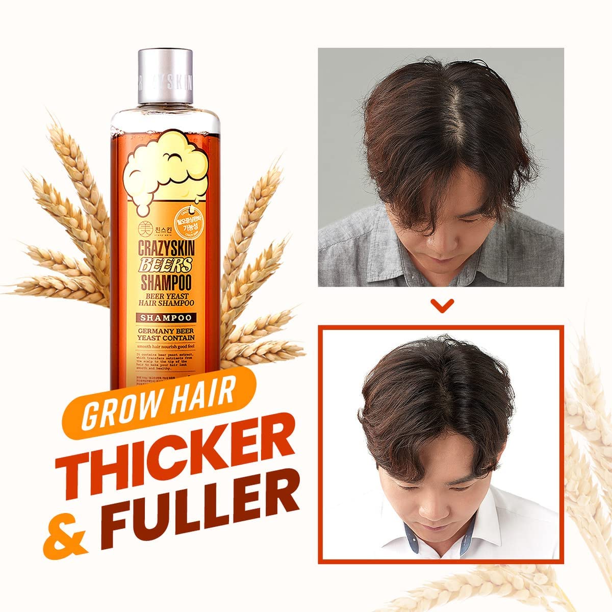 CRAZY SKIN German Beer Yeast Biotin Shampoo & Hair Treatment Set — Anti Hair Loss & Regrowth, 300ml + 200ml