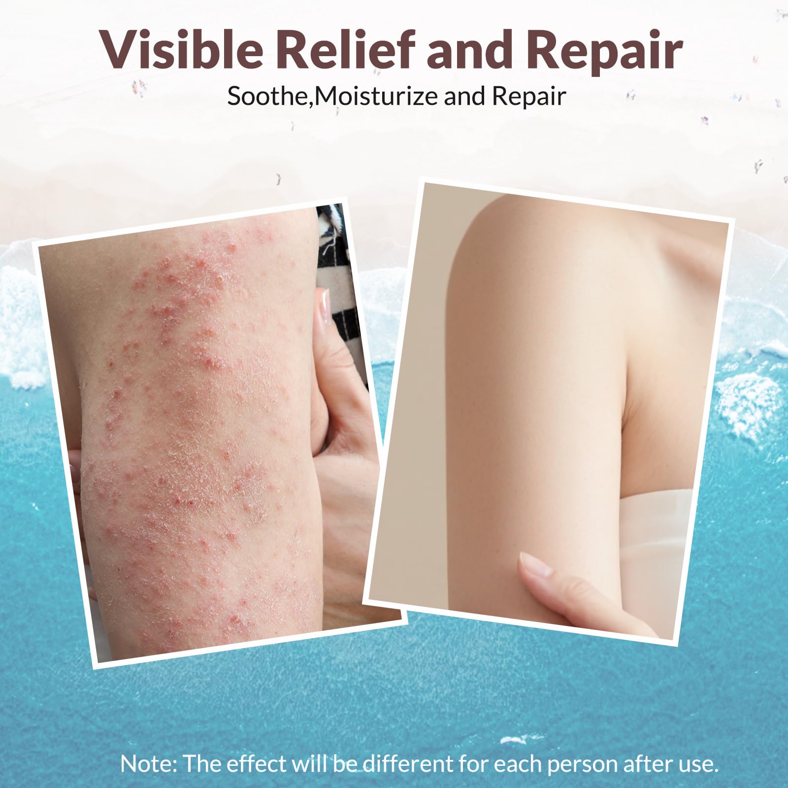 Crogooe Natural Soothing Eczema Cream – Fragrance-Free Hydration with Sea Moss, Aloe Vera & Oats (4 oz)