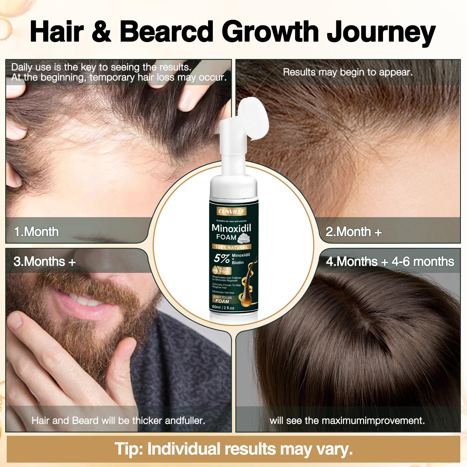 CUNVILEF 5% Minoxidil Foam for Men & Women – Hair Growth & Thicker Hair, 2.11 oz