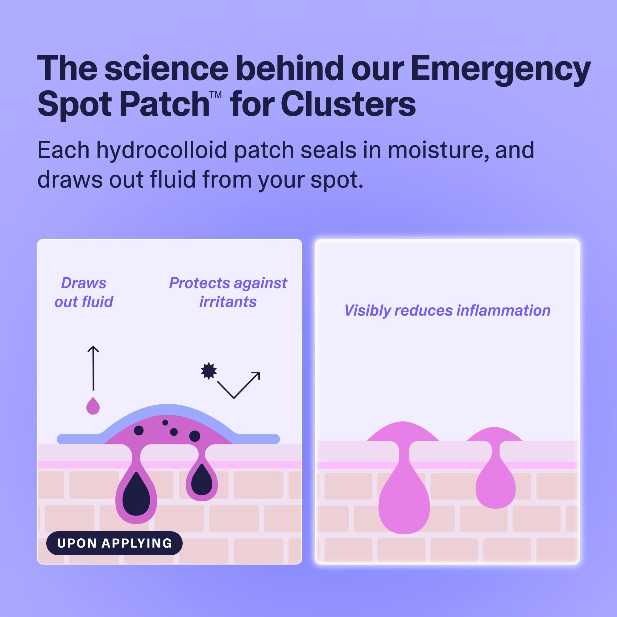 Curology Emergency Spot Patch Clusters – Large Hydrocolloid Pimple Patches (14 Count)