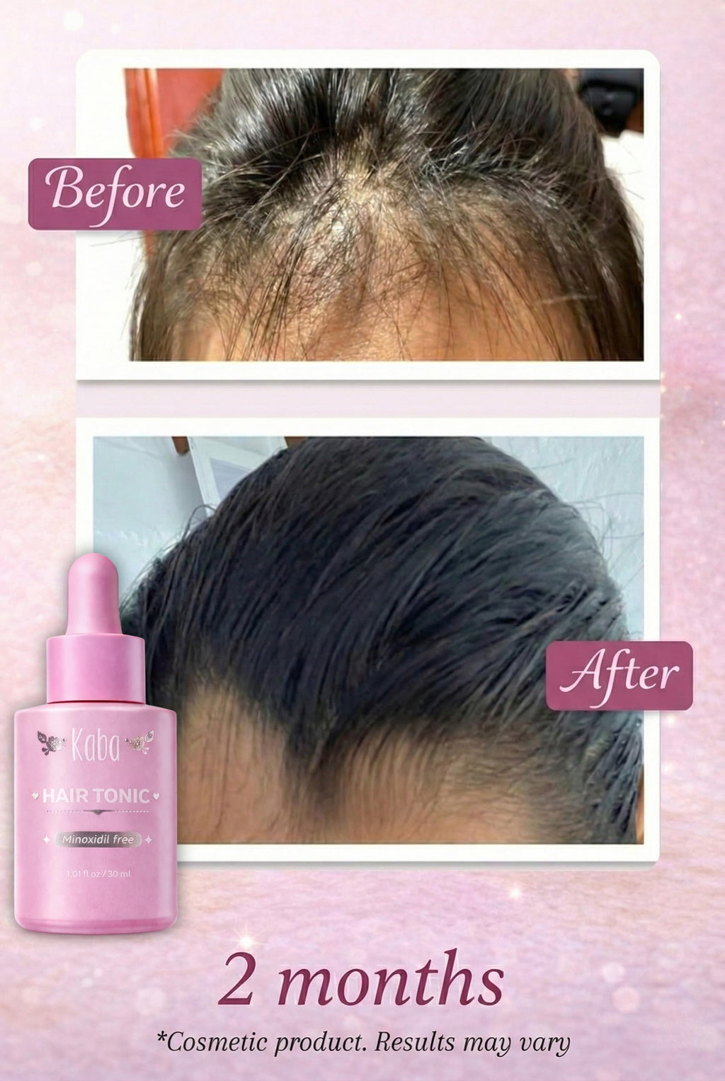 D'Luchi Kaba Tonic Hair Growth Serum | Growth Accelerator for Women – 1 oz