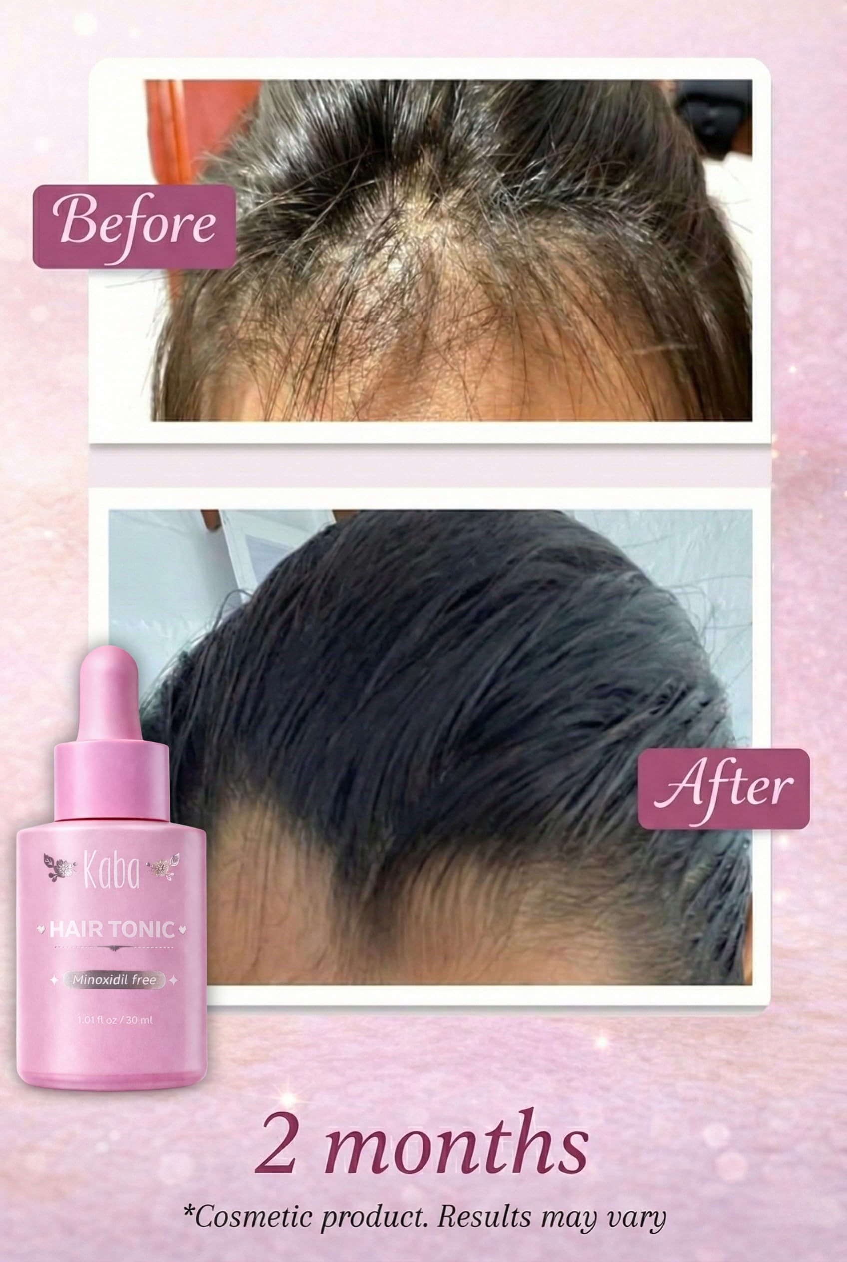 D'Luchi Kaba Tonic Hair Growth Serum | Growth Accelerator for Women – 1 oz
