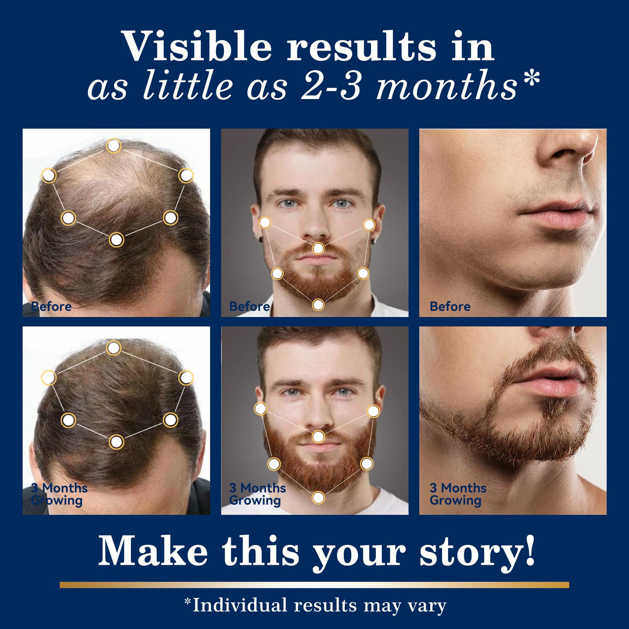 DAAZZS 5% Minoxidil Hair Growth Kit for Men & Women – Beard & Scalp Therapy, Biotin Included (2-Pack)