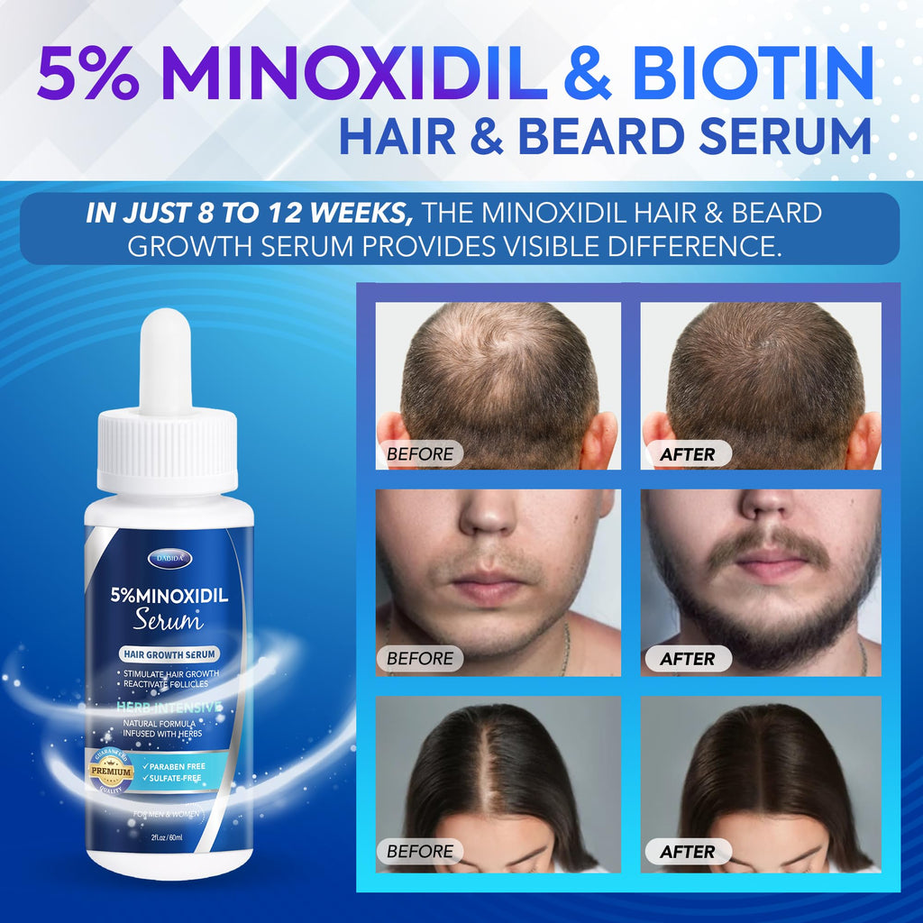 DABIDA 5% Minoxidil Hair Growth Serum for Men & Women – Extra Strength Beard & Scalp Regrowth, 60ml (4 Bottles)