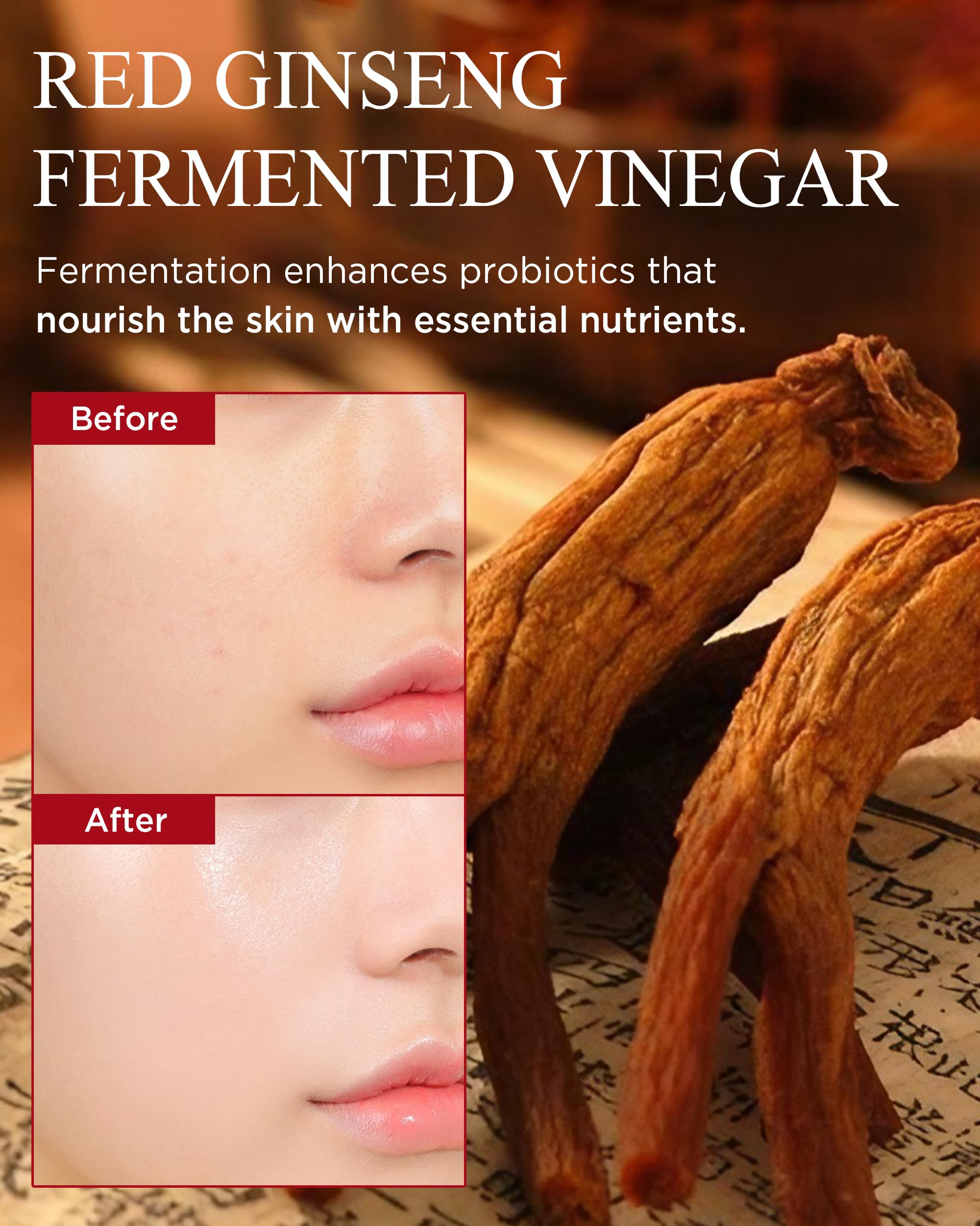 Danahan Bonyongo Red Ginseng Vinegar Toner – Rich Essence for Dry & Mature Skin | 6-Year Fermented Ginseng & pH Balance