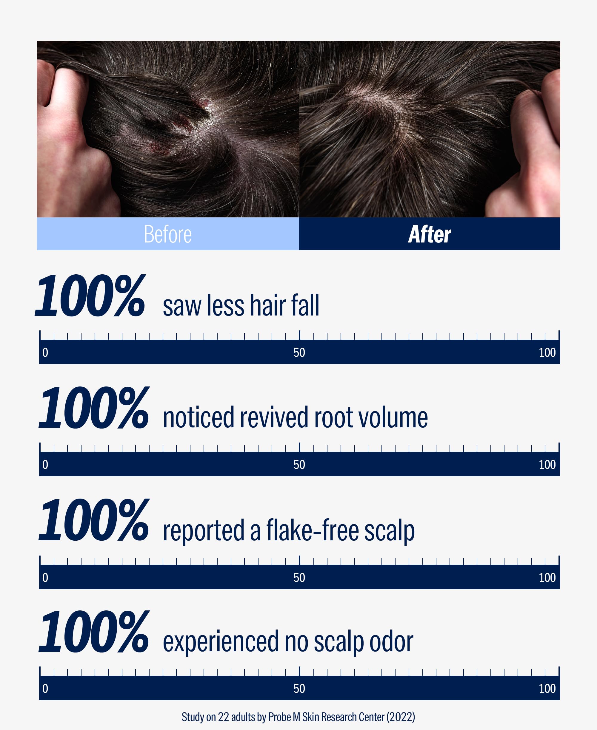 DASHU Revitalizing Protein Shampoo – For Dry, Itchy Scalp, Thinning Hair | 16.9 fl oz
