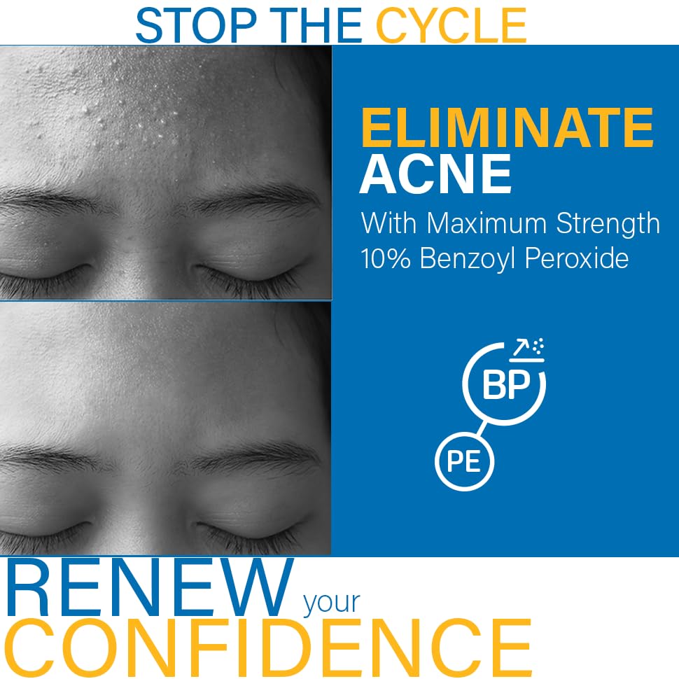 DCL Skincare B Prox Acne Treatment Cleanser — 10% Benzoyl Peroxide, Maximum Strength