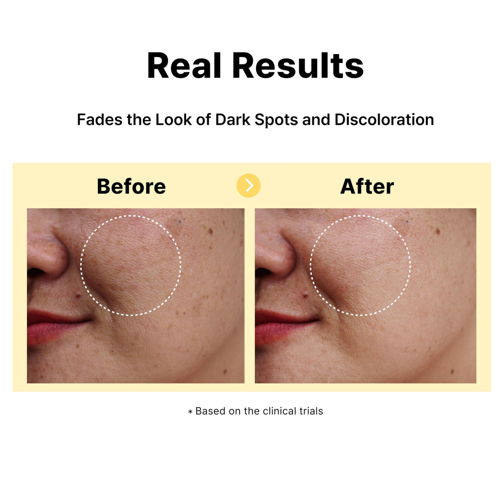 DearMYDEW 5% Tranexamic Acid Serum with 5% Niacinamide & Bakuchiol | Dark Spot Corrector