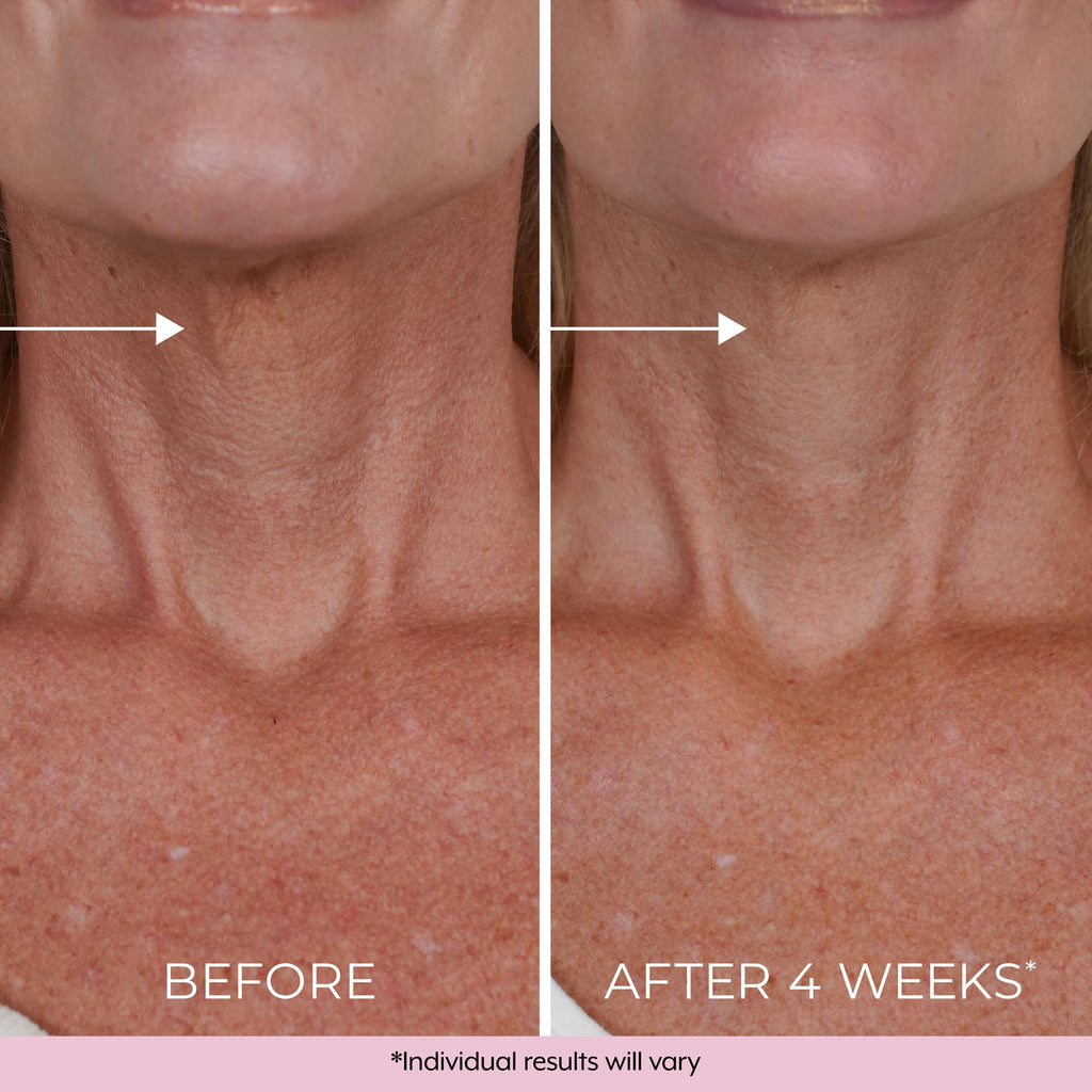 DEKLIDERM Neck Firming Cream – Retinol & Bakuchiol for Neck Lines & Firmness