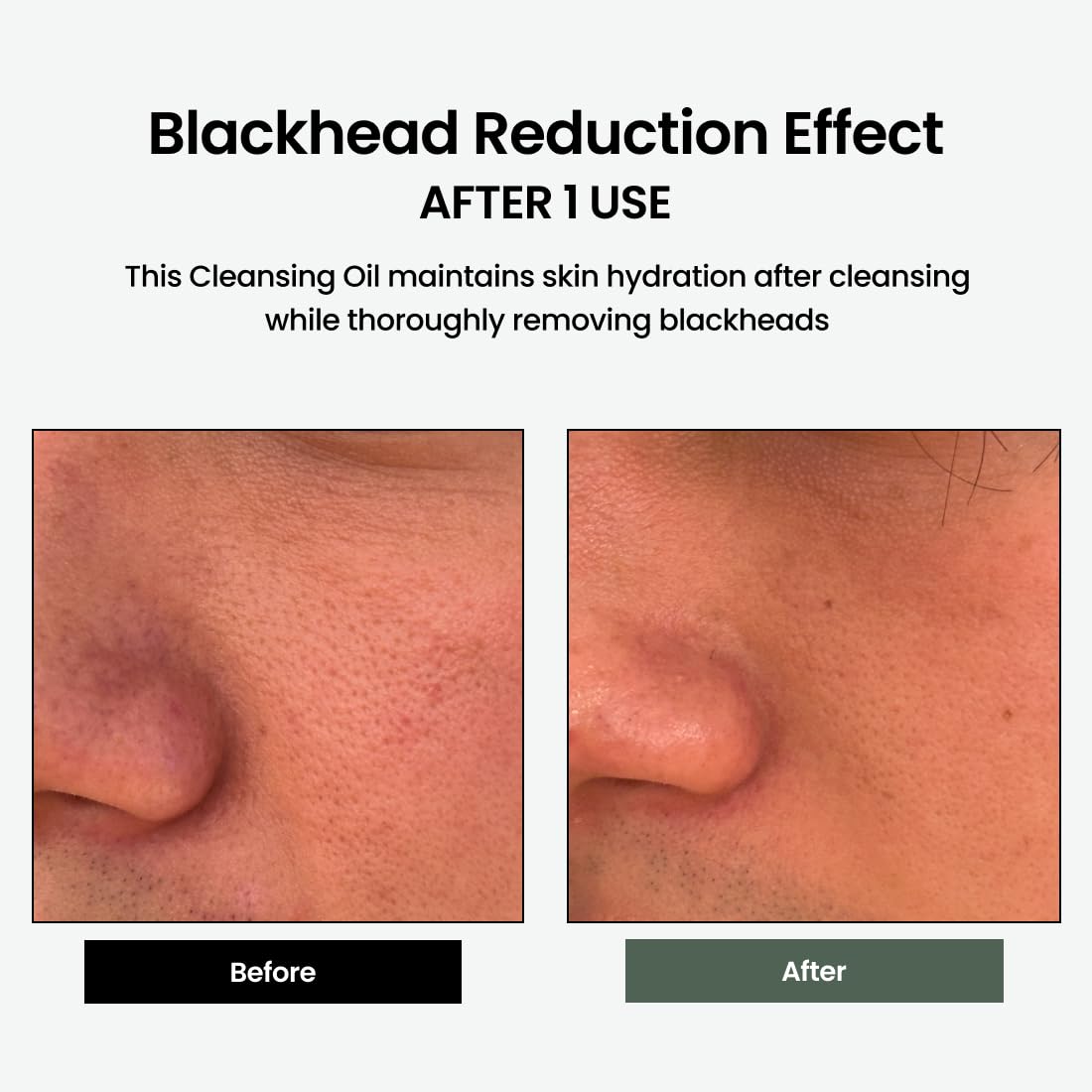 delphyr Liposome Daily Cleansing Oil — Gentle Makeup Remover & Blackhead Care for Sensitive Skin
