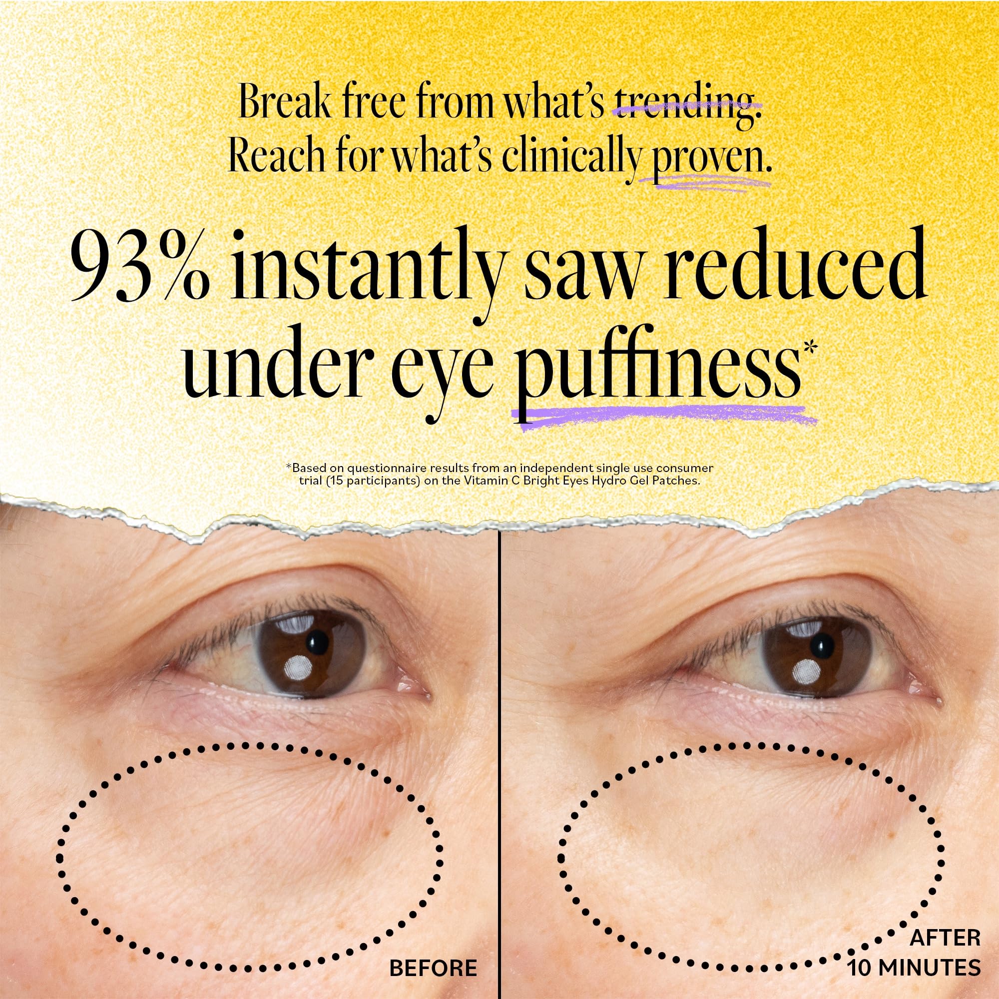Derma E Vitamin C Bright Eyes Hydro Gel Under Eye Patches – 10 Ct (5 Pairs) Allantoin, Caffeine & Vitamin B3