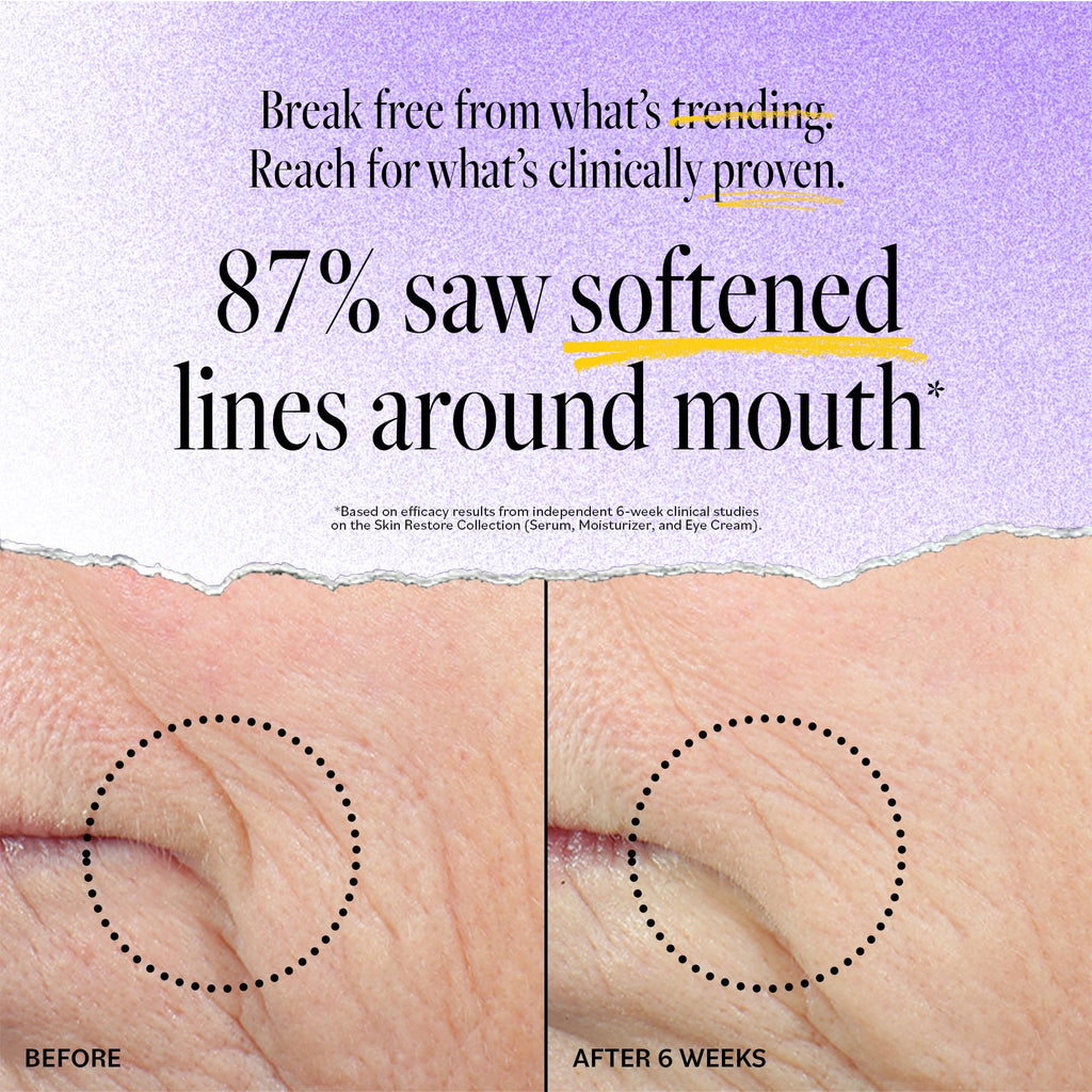 DERMA-E Advanced Peptides & Vegan Flora-Collagen Moisturizer – Hydrating Night Cream for Lines & Redness, 2 oz