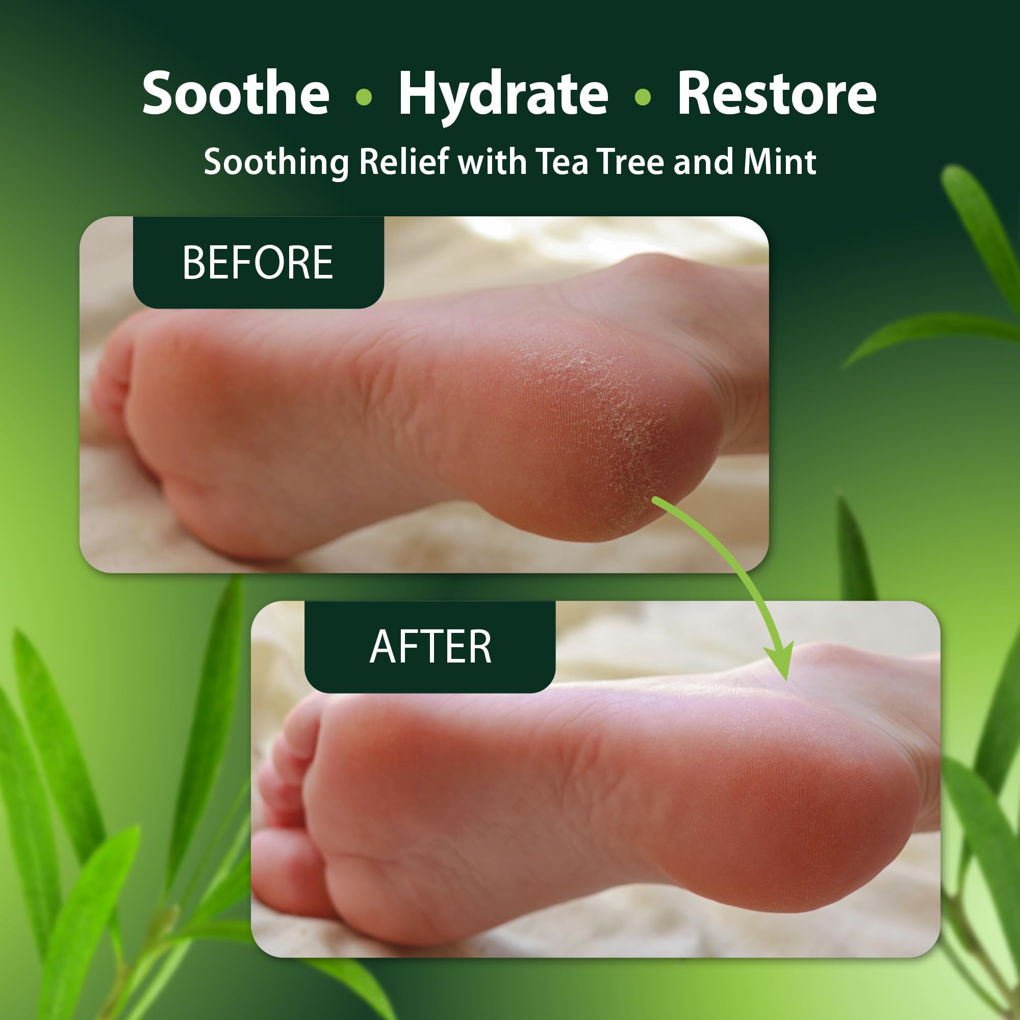 Derma-Nu Foot and Body Oil with Tea Tree Oil – Hydrating Foot Care for Dry Skin, Cracked Heels & Odor (4oz)