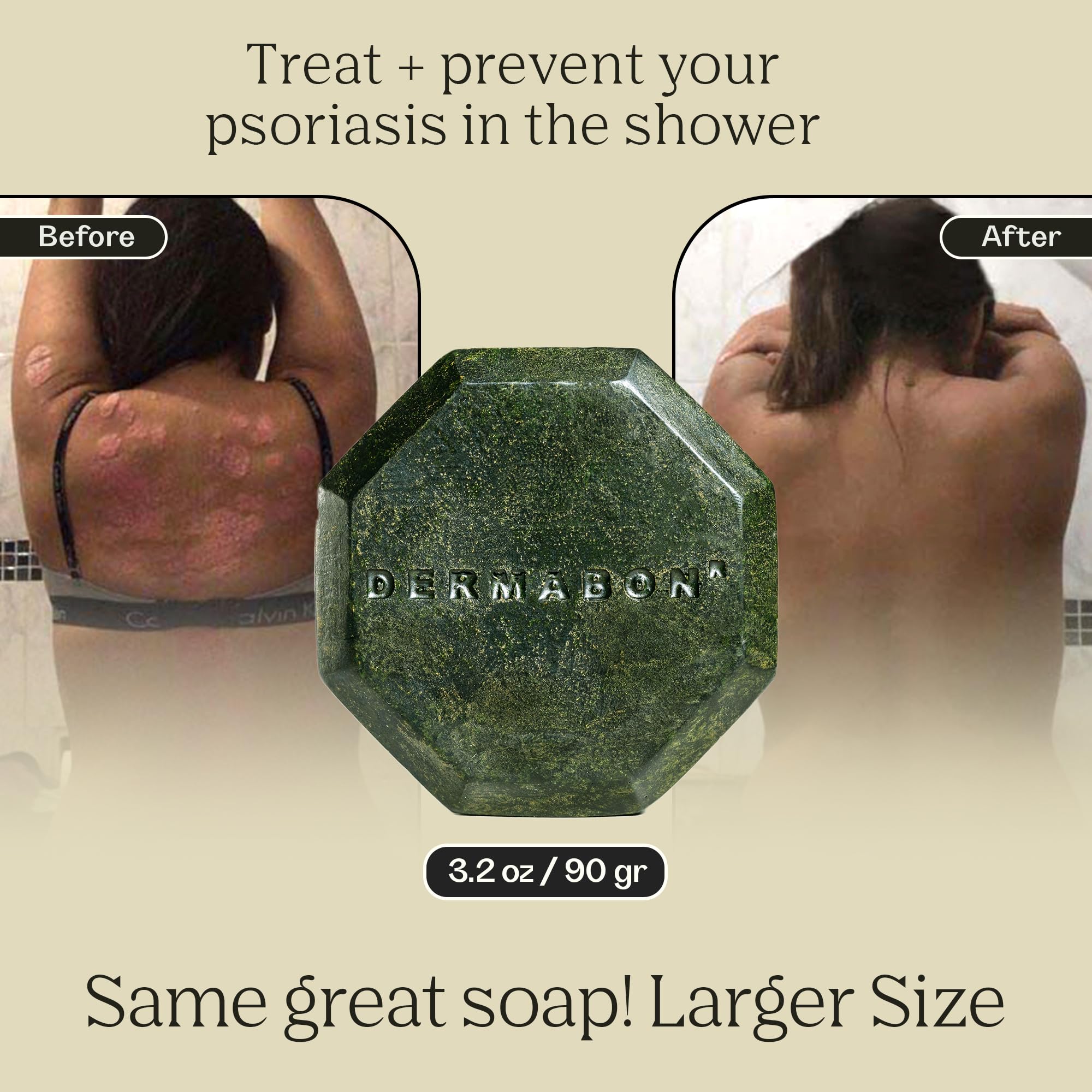 Dermabon Coal Tar Soap Bar 2% for Psoriasis, Dermatitis & Dandruff – 1 Pack