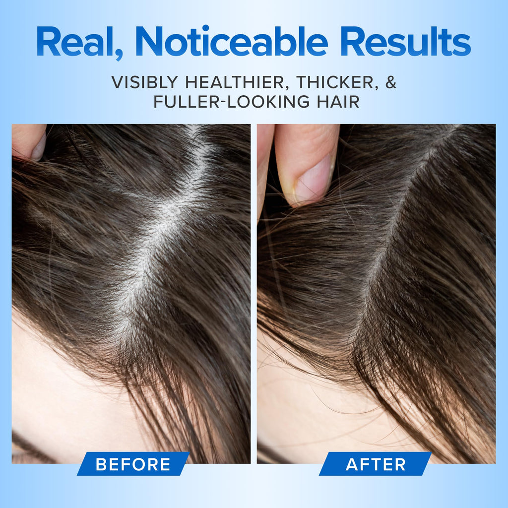 DermaChange Hair Growth Shampoo for Thinning Hair – Volumizing & Sulfate-Free