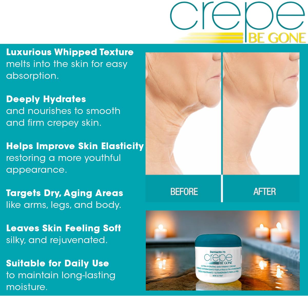 Dermactin Crepe Be Gone Body Souffle – Ultra Hydrating Cream for Crepey Skin | Classic 3 oz