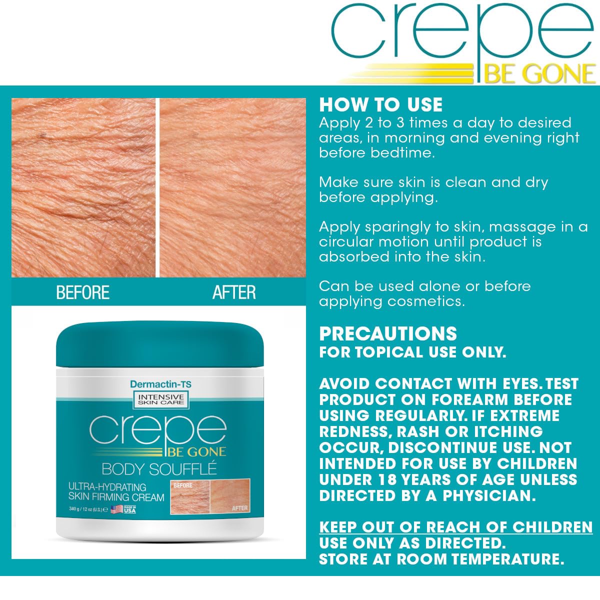 Dermactin Crepe Be Gone Body Souffle Large 12 oz – Ultra Hydrating Crepey Skin Cream