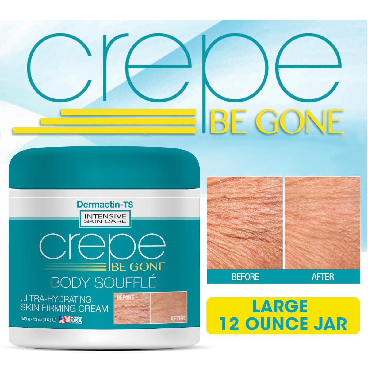 Dermactin Crepe Be Gone Body Souffle Large 12 oz – Ultra Hydrating Crepey Skin Cream