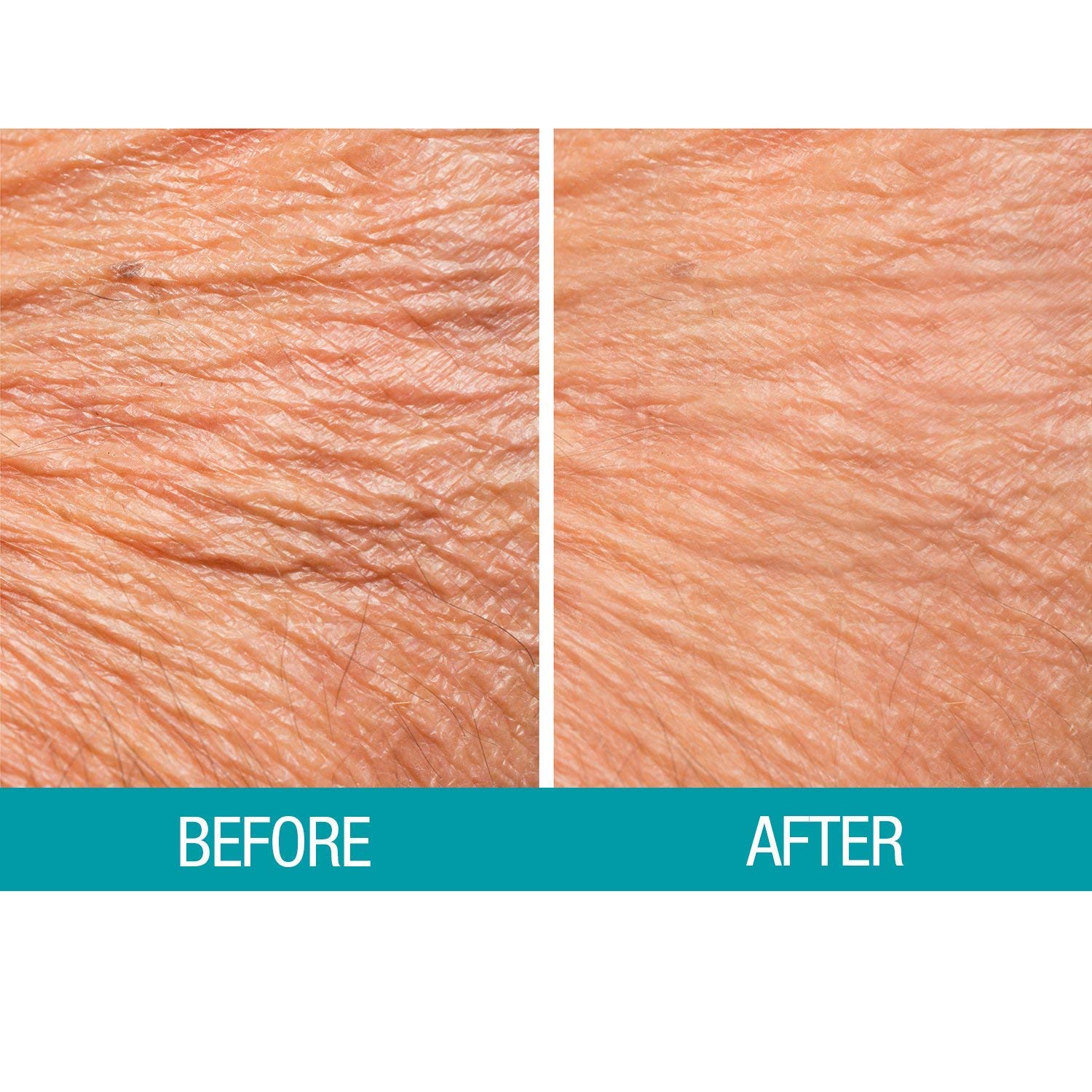 Dermactin Crepe Be Gone Body Souffle – Ultra Hydrating Cream for Crepey Skin | Classic 3 oz